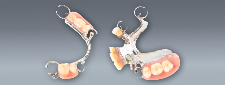 partial-dentures-image-for-parent-page