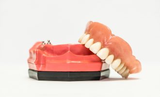 Implant Overdentures - A Great Fit - South Calgary Denture - Best Denture Care Calgary