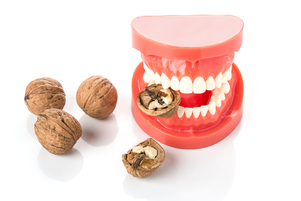Se avete una protesi dentaria evitate questi 5 alimenti | South Calgary Denture
